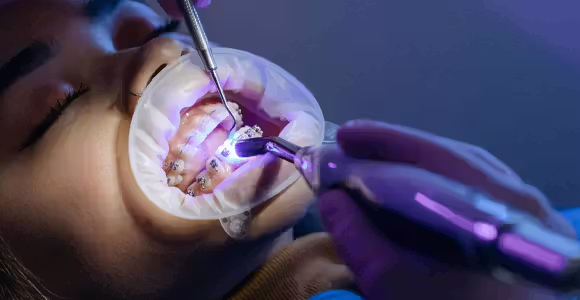 Resultado de endodoncia después