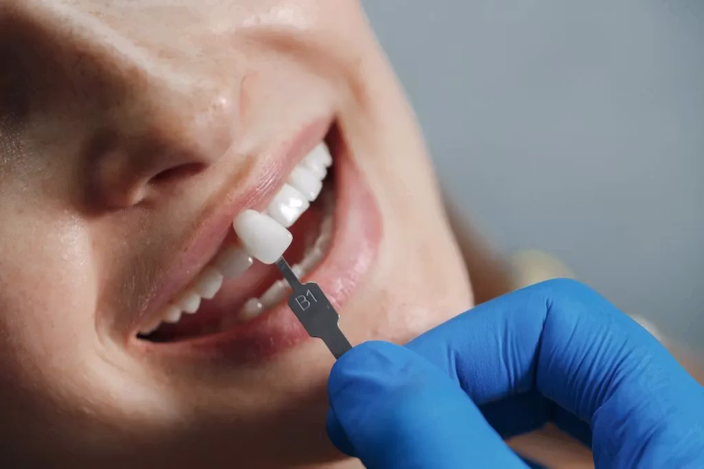 Resultado de corona dental